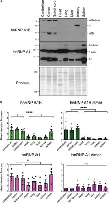 hnRNP A1B, a Splice Variant of HNRNPA1, Is Spatially and Temporally Regulated